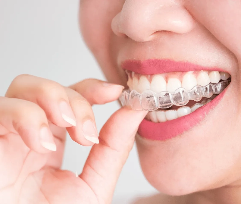Patient holding clear aligners at VIVA Orthodontics