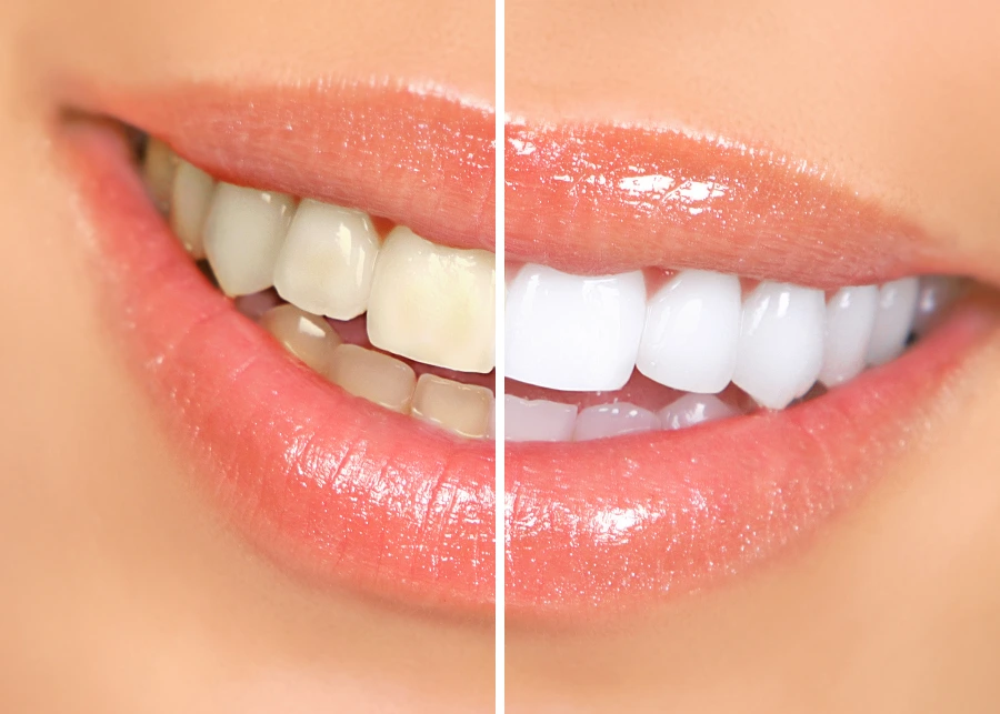 Treatment area at VIVA Orthodontics in Bountiful, UT
