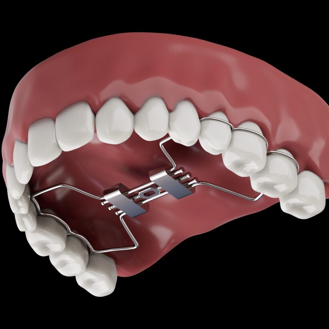 bountiful orthodontist