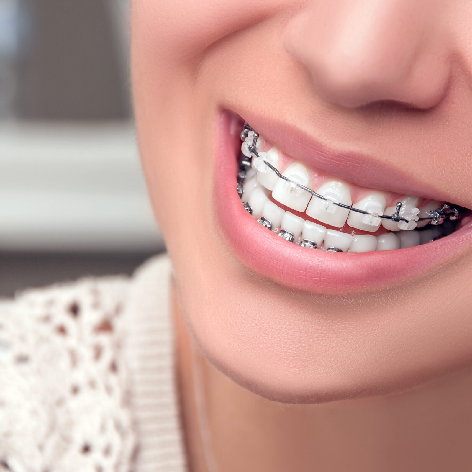 bountiful orthodontics