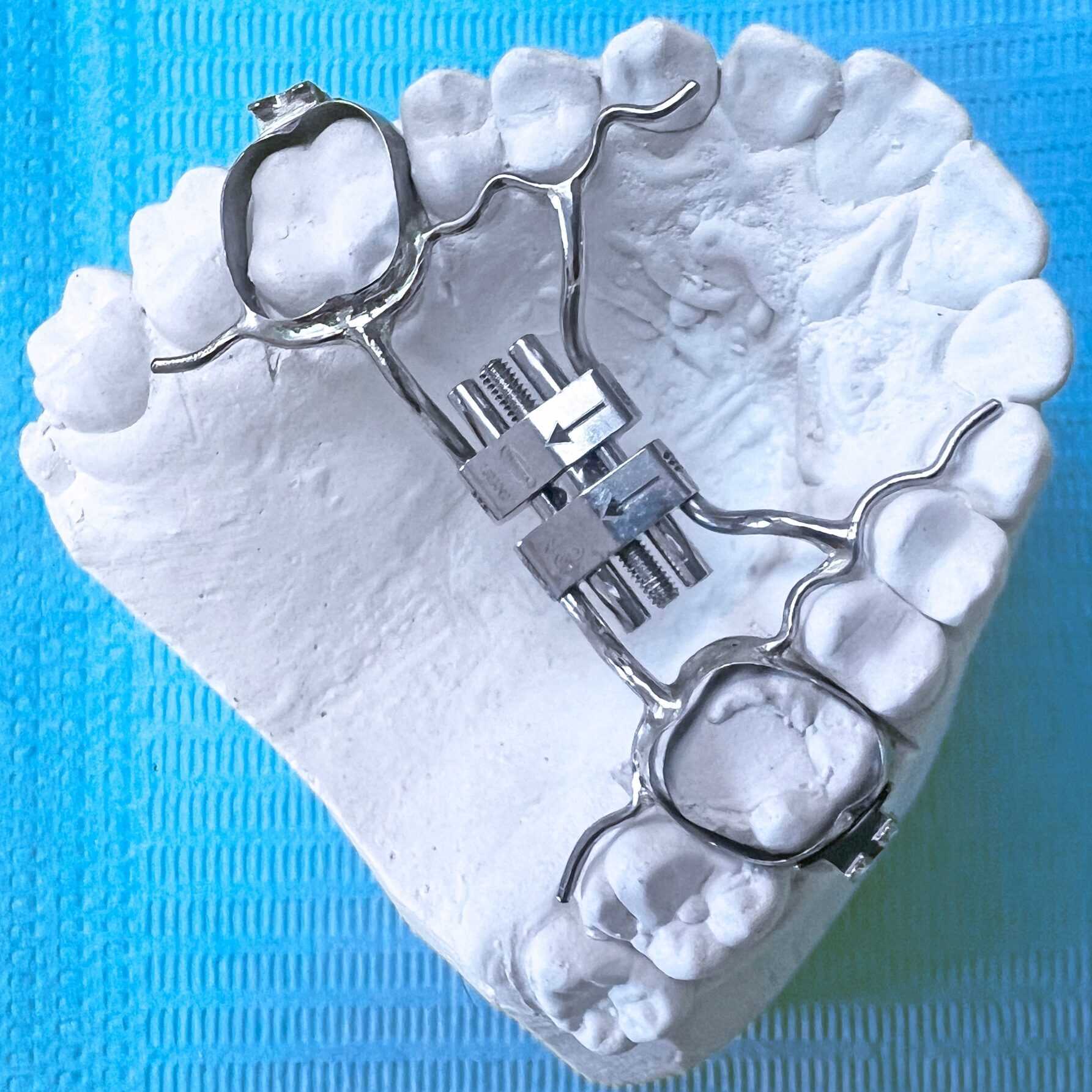 orthodontist bountiful ut